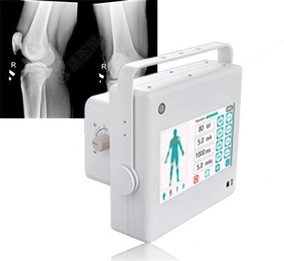 ftlf 10 1 kw پورٹیبل Xray مشین